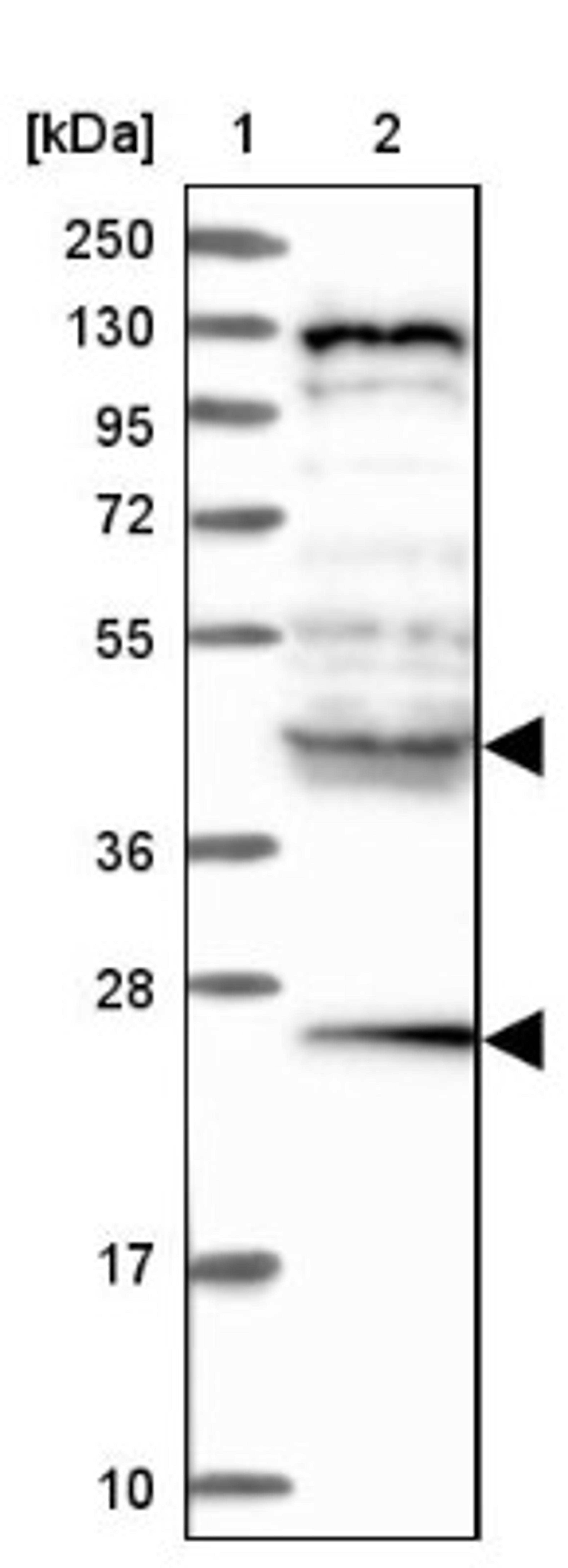 Western Blot: HYI Antibody [NBP1-81659] - Lane 1: Marker [kDa] 250, 130, 95, 72, 55, 36, 28, 17, 10<br/>Lane 2: Human cell line RT-4