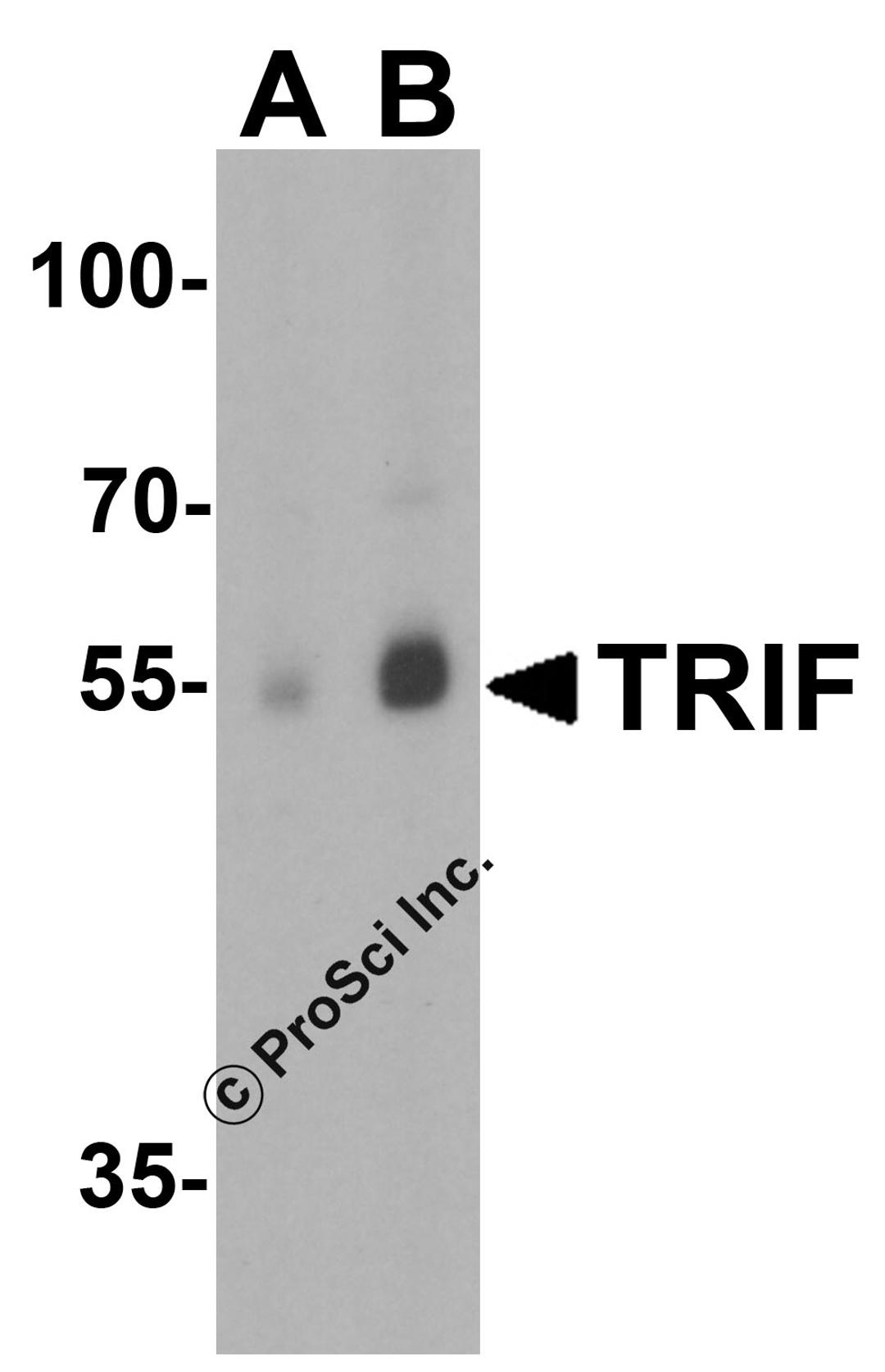 Western blot analysis of TRIF in human lung lysate with TRIF antibody at (A) 1 and (B) 2 μg/mL.