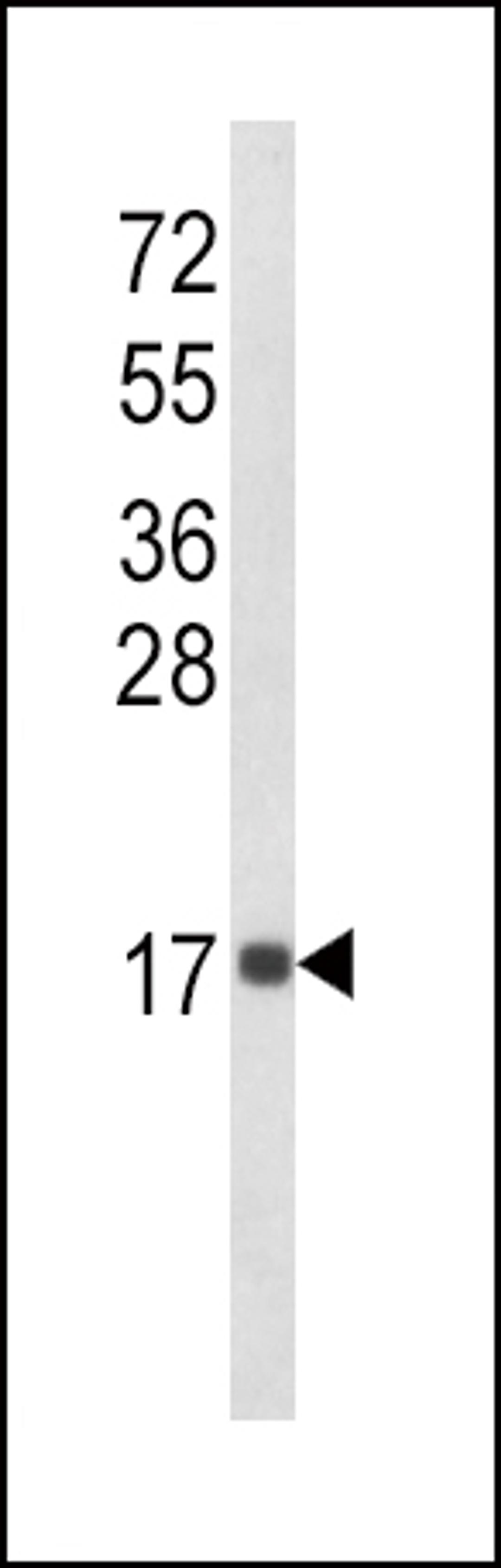 Western blot analysis of IL8 Antibody in MDA-MB468 cell line lysates (35ug/lane)