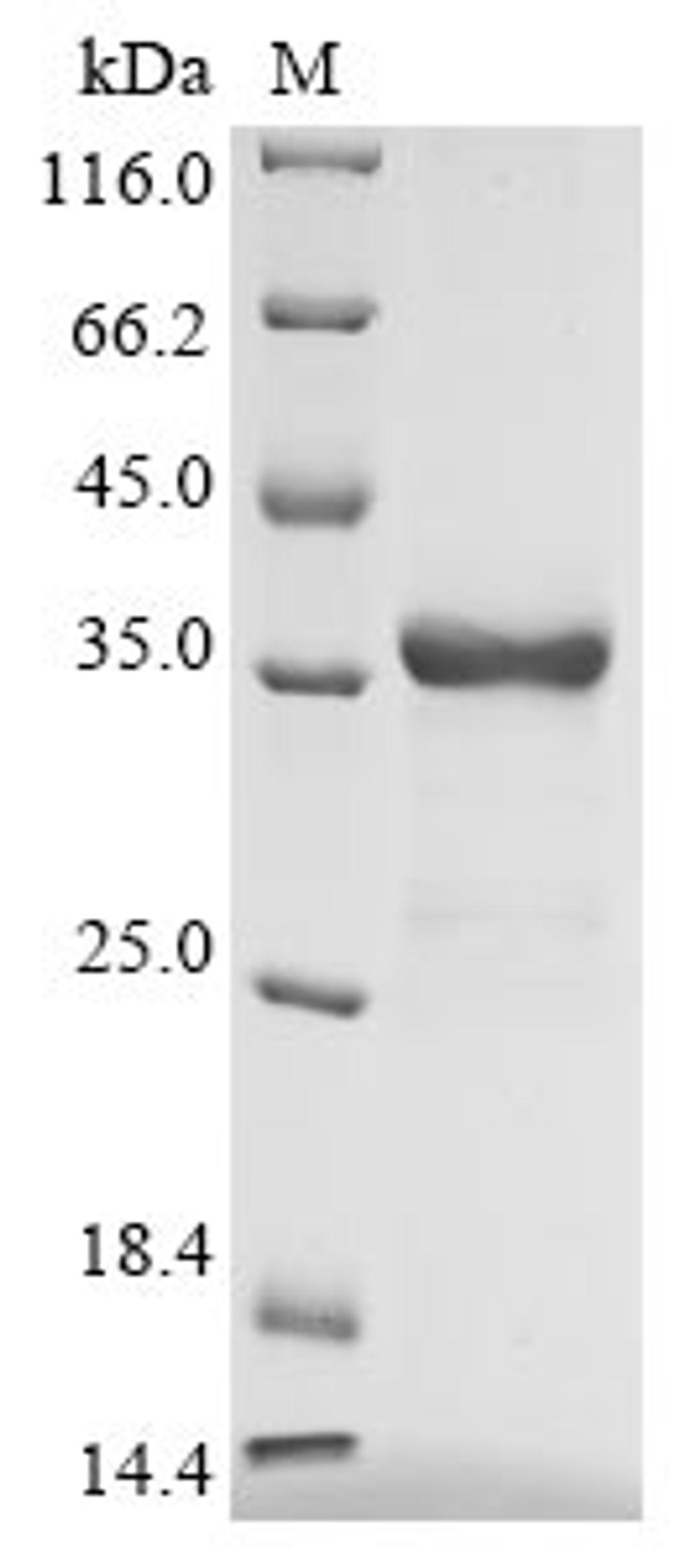 (Tris-Glycine gel) Discontinuous SDS-PAGE (reduced) with 5% enrichment gel and 15% separation gel.