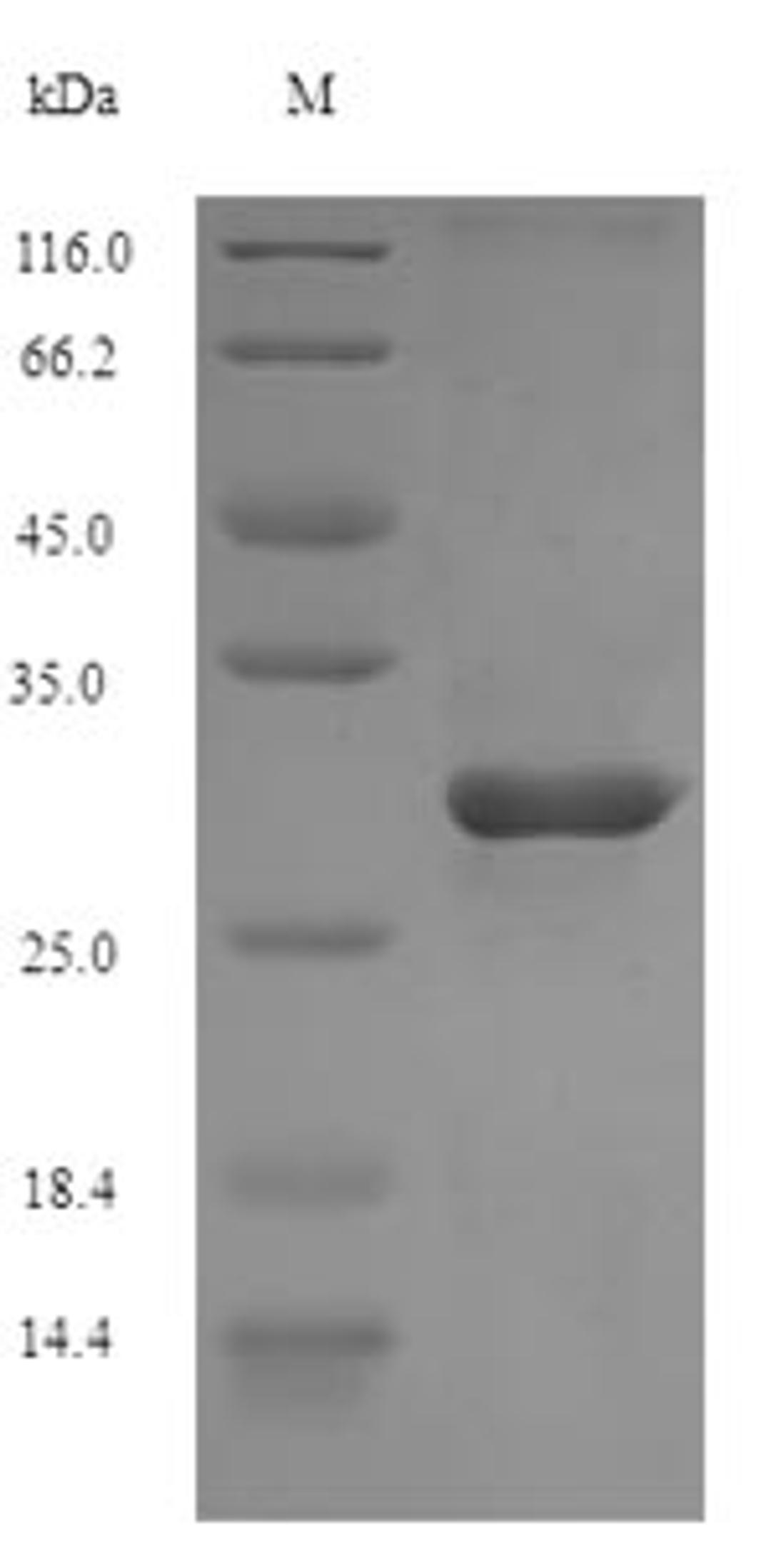 (Tris-Glycine gel) Discontinuous SDS-PAGE (reduced) with 5% enrichment gel and 15% separation gel.