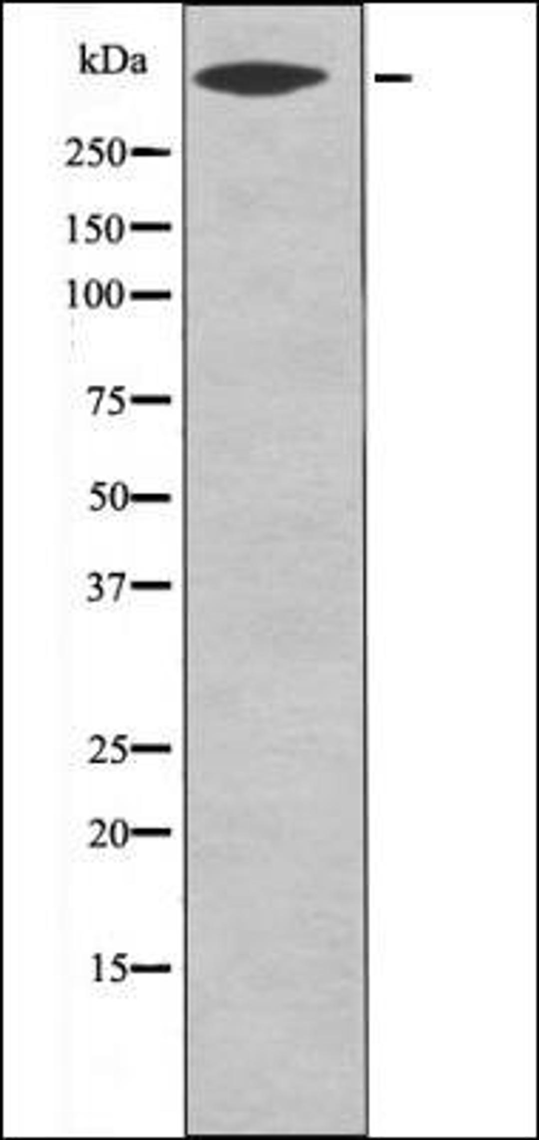 Western blot analysis of LOVO whole cell lysates using CD91 -Phospho-Ser4520- antibody