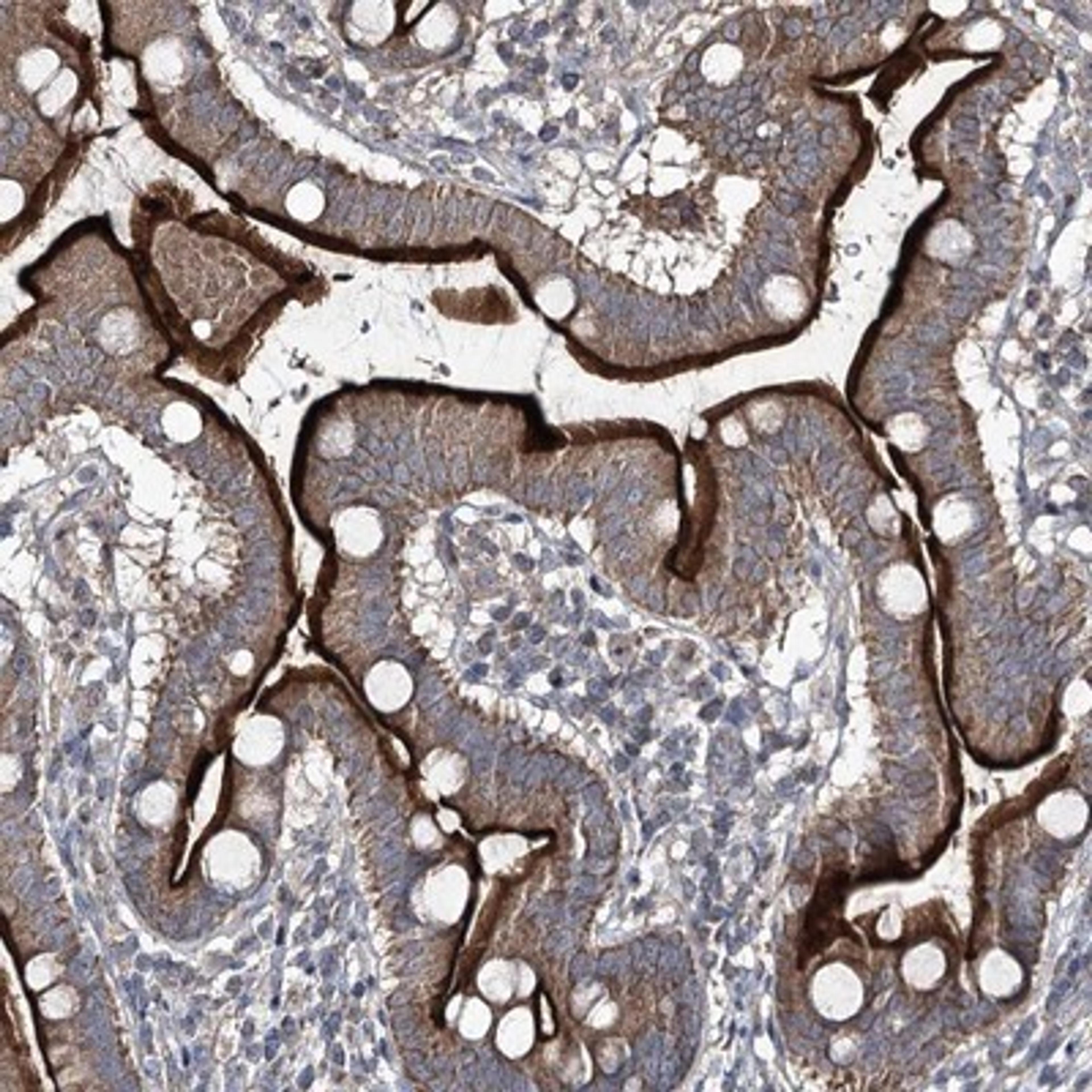 Immunohistochemistry-Paraffin: FANCL Antibody [NBP1-84758] - Staining of human duodenum shows strong membranous and cytoplasmic positivity in glandular cells.