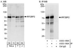 Detection of human IRF2BP2 by western blot and immunoprecipitation.