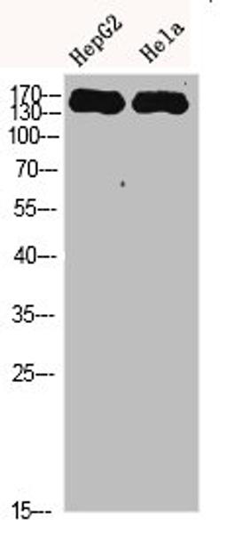 Western Blot analysis of HEPG2 Hela cells using CYFIP2 Polyclonal Antibody diluted at 1:500. Secondary antibody  was diluted at 1:20000