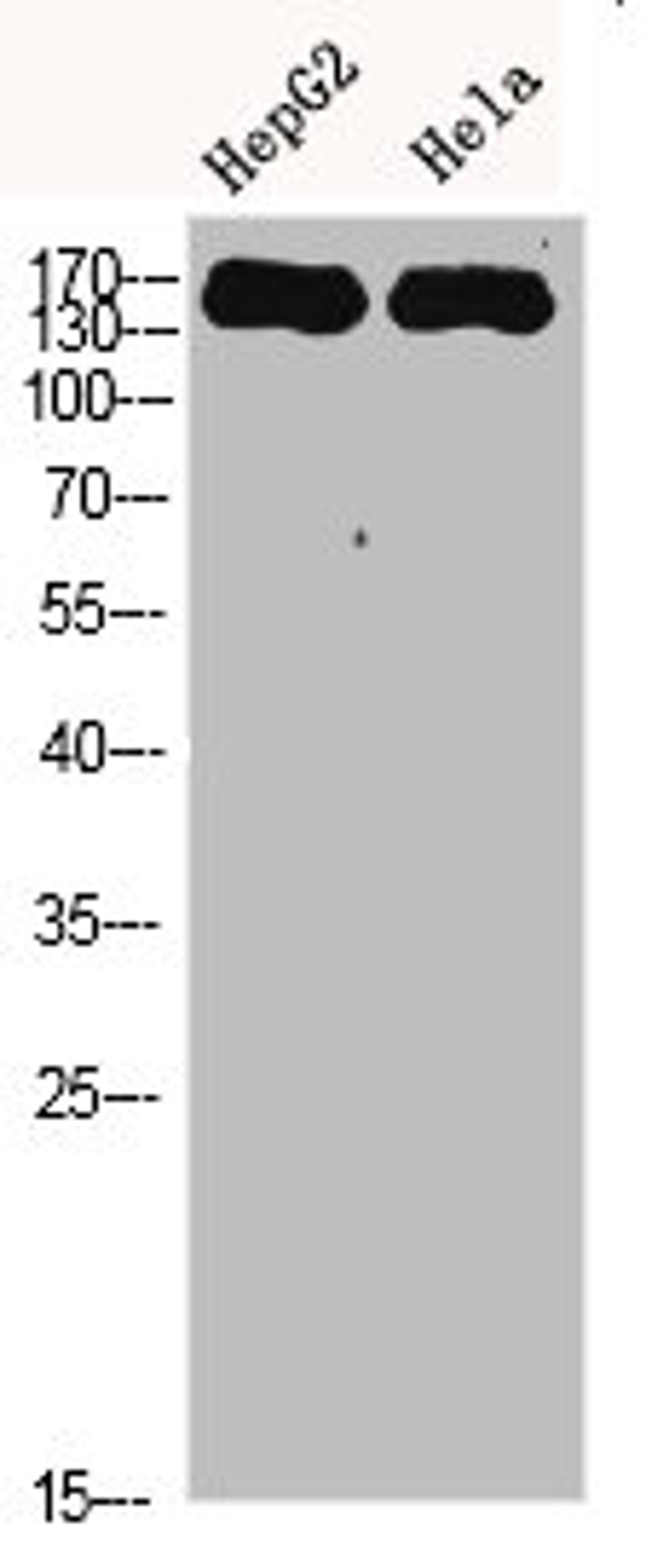 Western Blot analysis of HEPG2 Hela cells using CYFIP2 Polyclonal Antibody diluted at 1:500. Secondary antibody  was diluted at 1:20000
