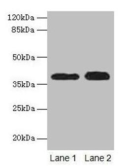 Western blot. All lanes: CTSL antibody at 12µg/ml. Lane 1: A549 whole cell lysate. Lane 2: HepG2 whole cell lysate. Secondary. Goat polyclonal to rabbit IgG at 1/10000 dilution. Predicted band size: 38 kDa. Observed band size: 38 kDa