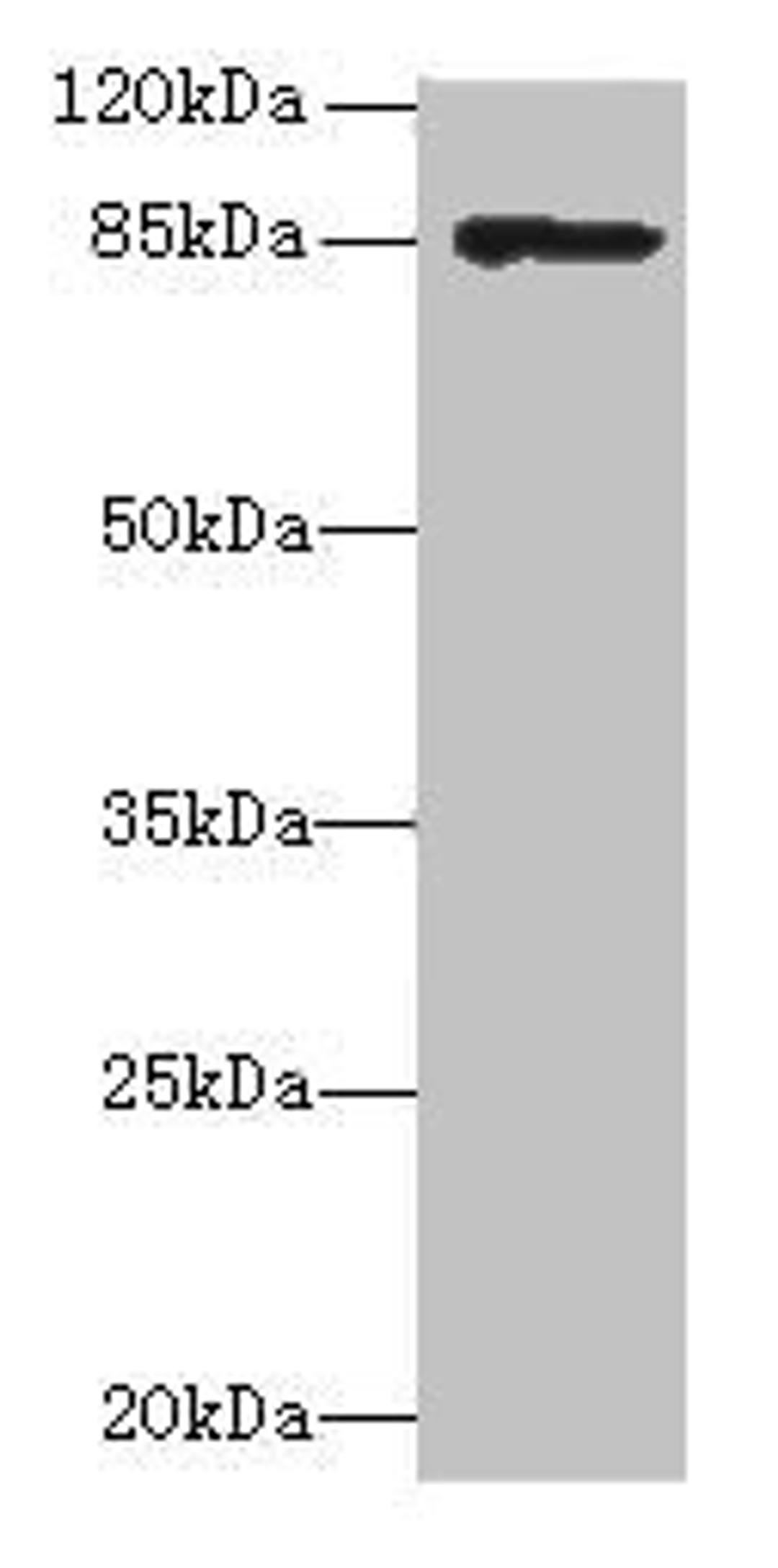 Western blot analysis of 293T whole cell lysate using inlA antibody