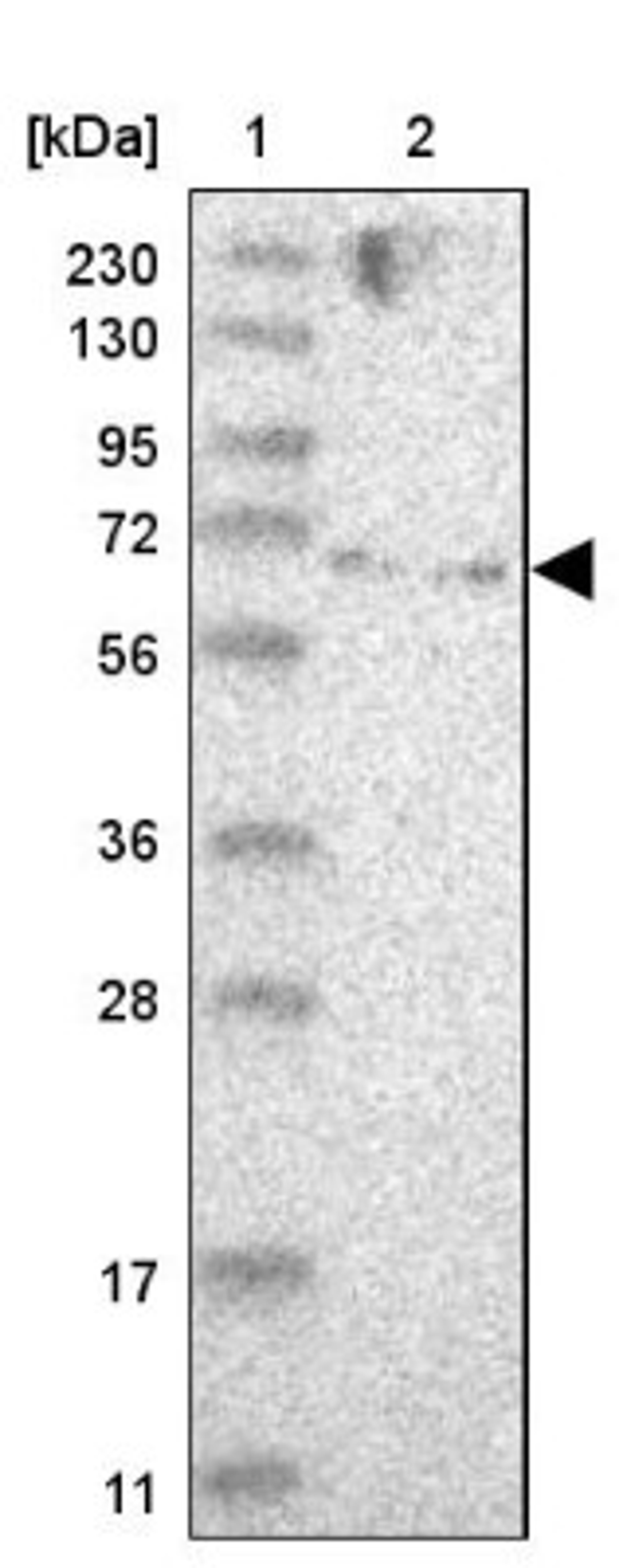 Western Blot: ZNF274 Antibody [NBP1-80597] - Lane 1: Marker [kDa] 230, 130, 95, 72, 56, 36, 28, 17, 11<br/>Lane 2: Human cell line RT-4