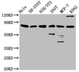 Western Blot. Positive WB detected in: Hela whole cell lysate, SH-SY5Y whole cell lysate, NIH/3T3 whole cell lysate, 293T whole cell lysate, MCF-7 whole cell lysate, K562 whole cell lysate. All lanes: KMT2E antibody at 3.1ug/ml. Secondary. Goat polyclonal to rabbit IgG at 1/50000 dilution. Predicted band size: 205, 196, 69, 99, 186, 181, 201, 132 kDa. Observed band size: 80 kDa. 