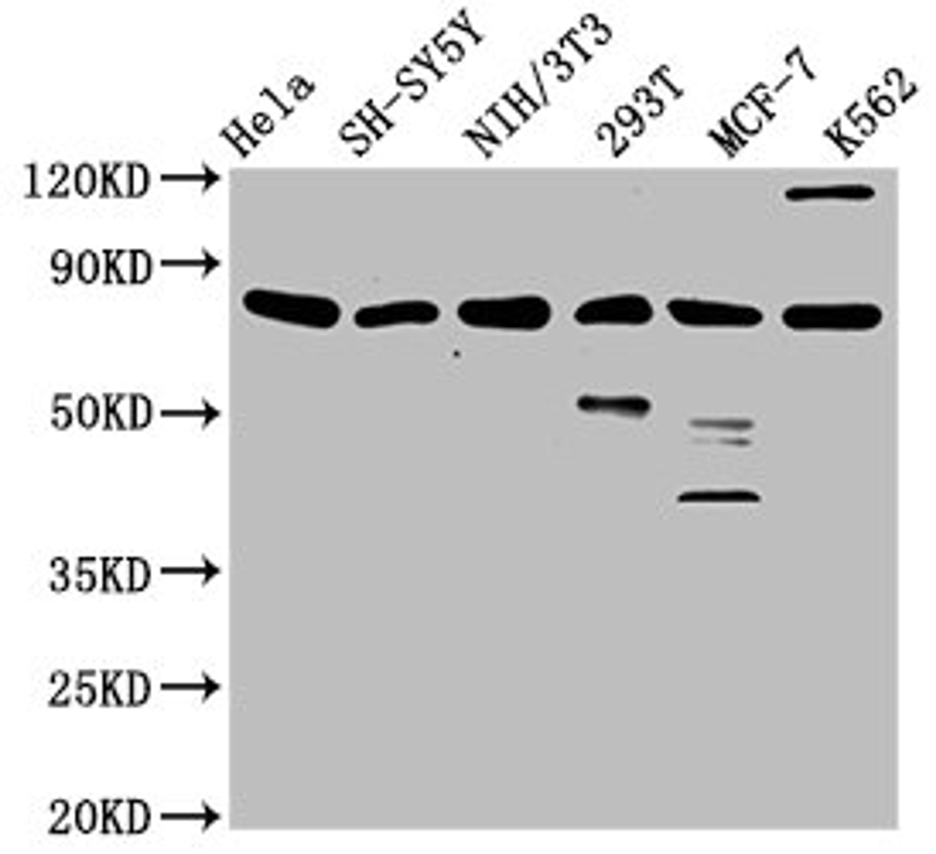Western Blot. Positive WB detected in: Hela whole cell lysate, SH-SY5Y whole cell lysate, NIH/3T3 whole cell lysate, 293T whole cell lysate, MCF-7 whole cell lysate, K562 whole cell lysate. All lanes: KMT2E antibody at 3.1ug/ml. Secondary. Goat polyclonal to rabbit IgG at 1/50000 dilution. Predicted band size: 205, 196, 69, 99, 186, 181, 201, 132 kDa. Observed band size: 80 kDa. 
