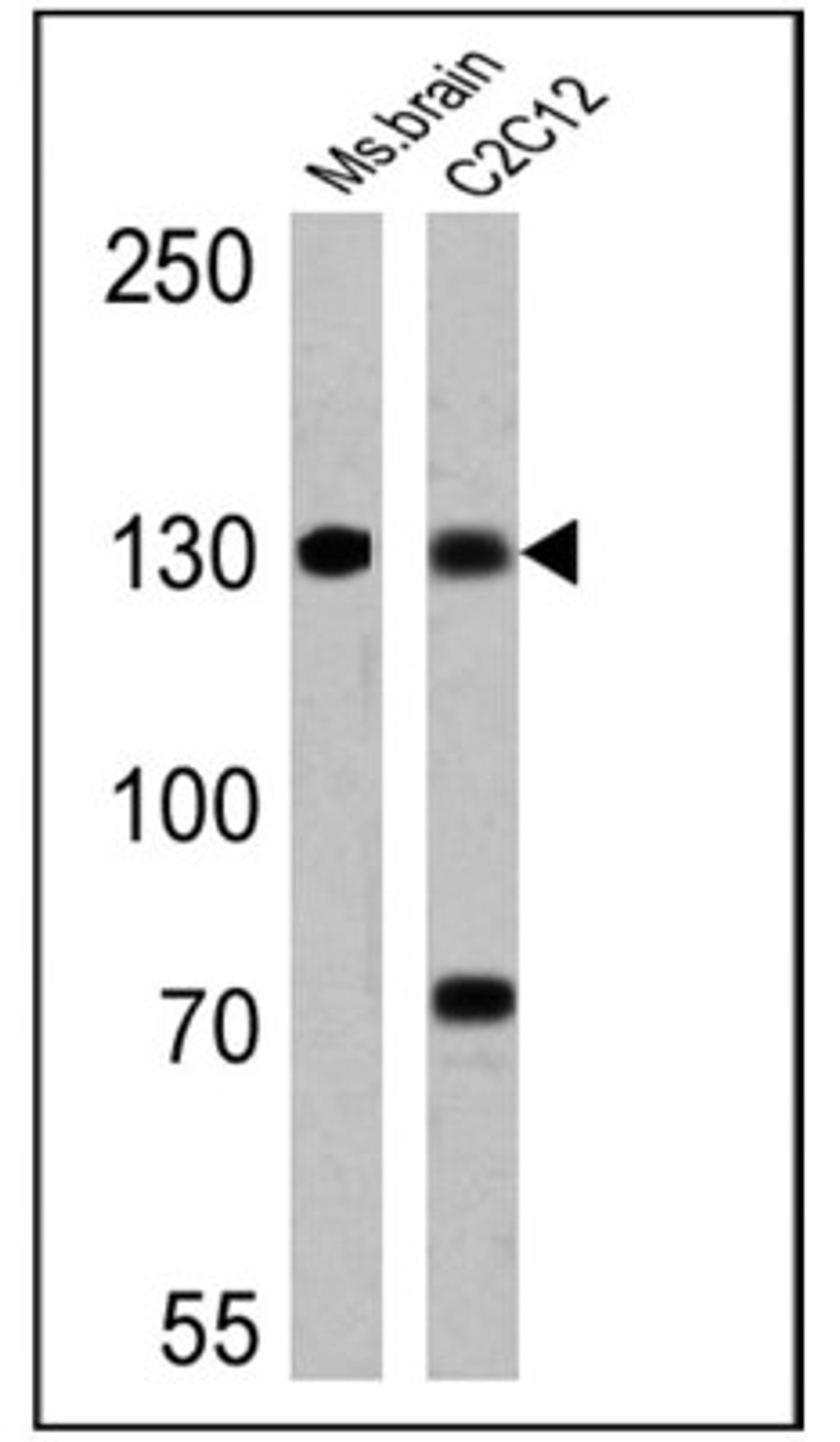 Western Blot: uNOS Antibody (NOS-3F7-B11 B5) [NB120-2801] - Analysis of 25 ug of mouse brain (lane 1) and C2C12 (lane 2) lysates.