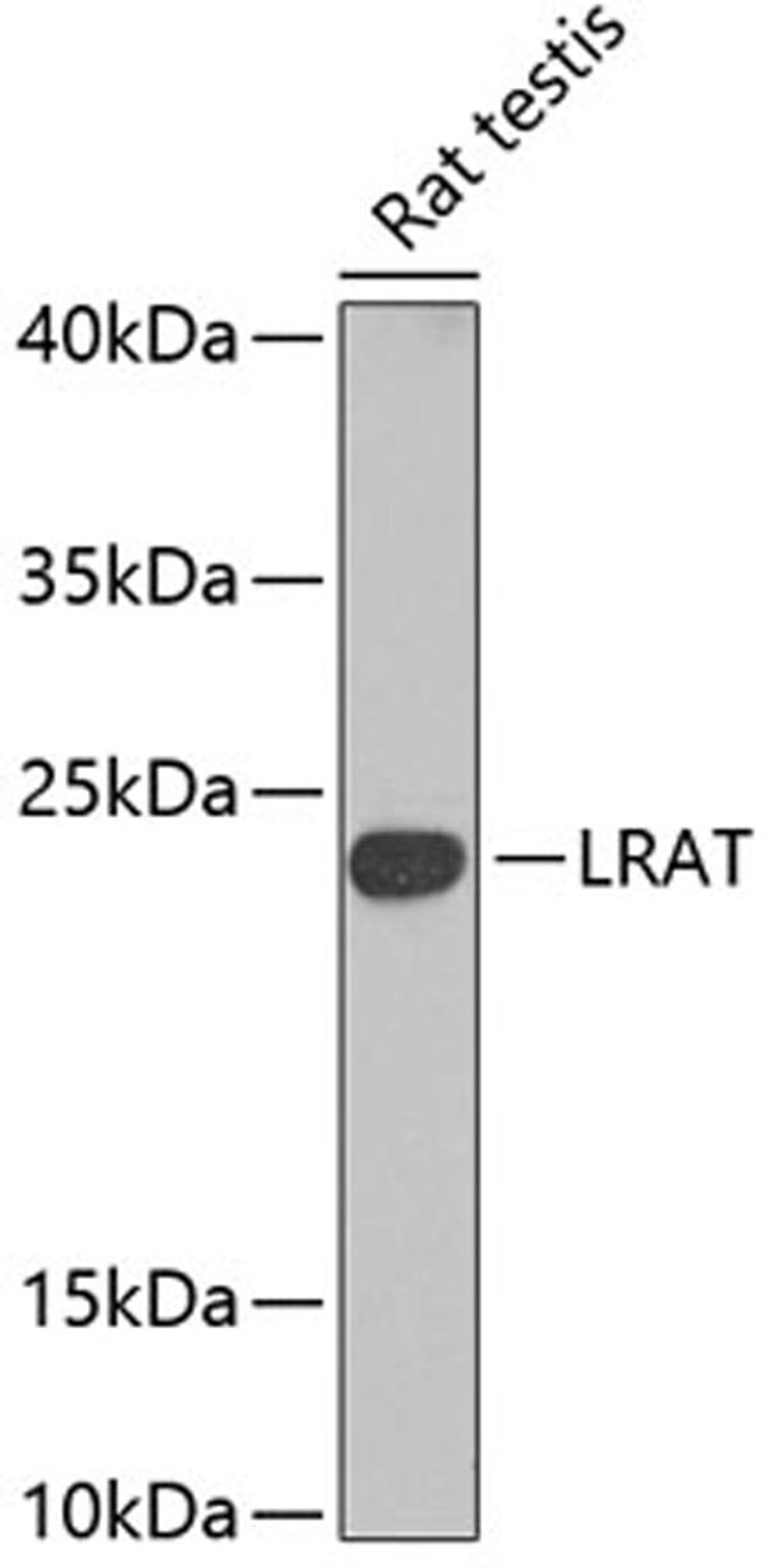 Western blot - Lrat antibody (A6647)