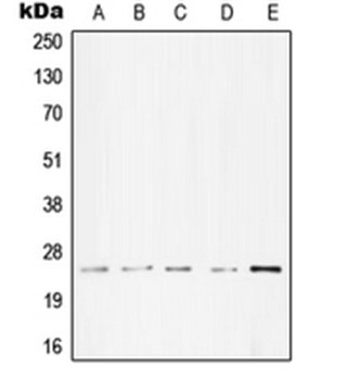 Western blot analysis of A431 (Lane 1), Molt4 (Lane 2), A549 (Lane 3), NIH3T3 (Lane 4), PC12 (Lane 5) whole cell lysates using TNNI3 antibody