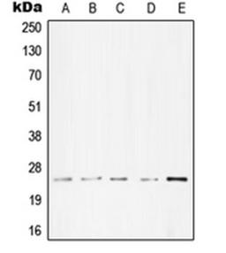 Western blot analysis of A431 (Lane 1), Molt4 (Lane 2), A549 (Lane 3), NIH3T3 (Lane 4), PC12 (Lane 5) whole cell lysates using TNNI3 antibody