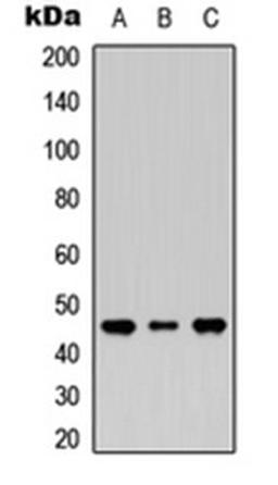 Western blot analysis of HEK293T (Lane 1), Raw264.7 (Lane 2), H9C2 (Lane 3) whole cell lysates using MASP1 LC antibody