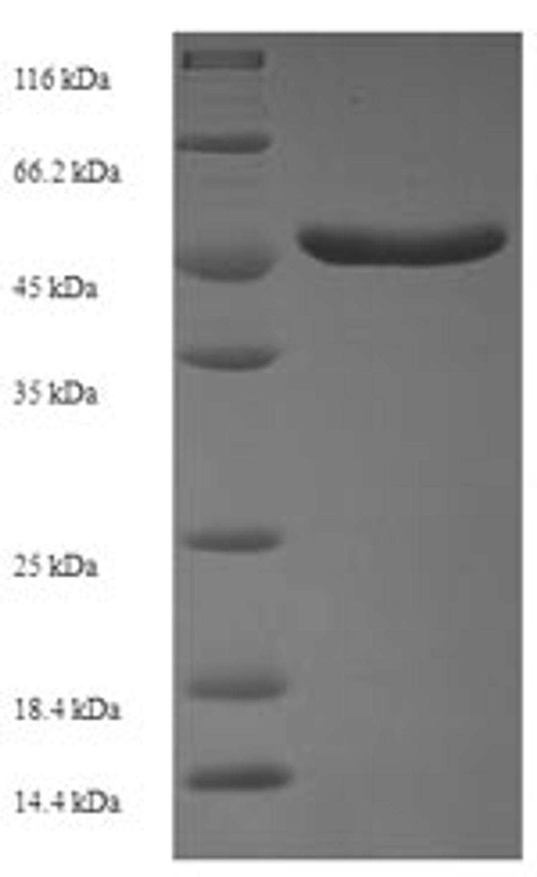 (Tris-Glycine gel) Discontinuous SDS-PAGE (reduced) with 5% enrichment gel and 15% separation gel.