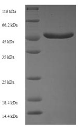 (Tris-Glycine gel) Discontinuous SDS-PAGE (reduced) with 5% enrichment gel and 15% separation gel.
