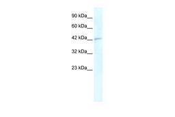 Antibody used in WB on Human Daudi at 0.2-1 ug/ml.