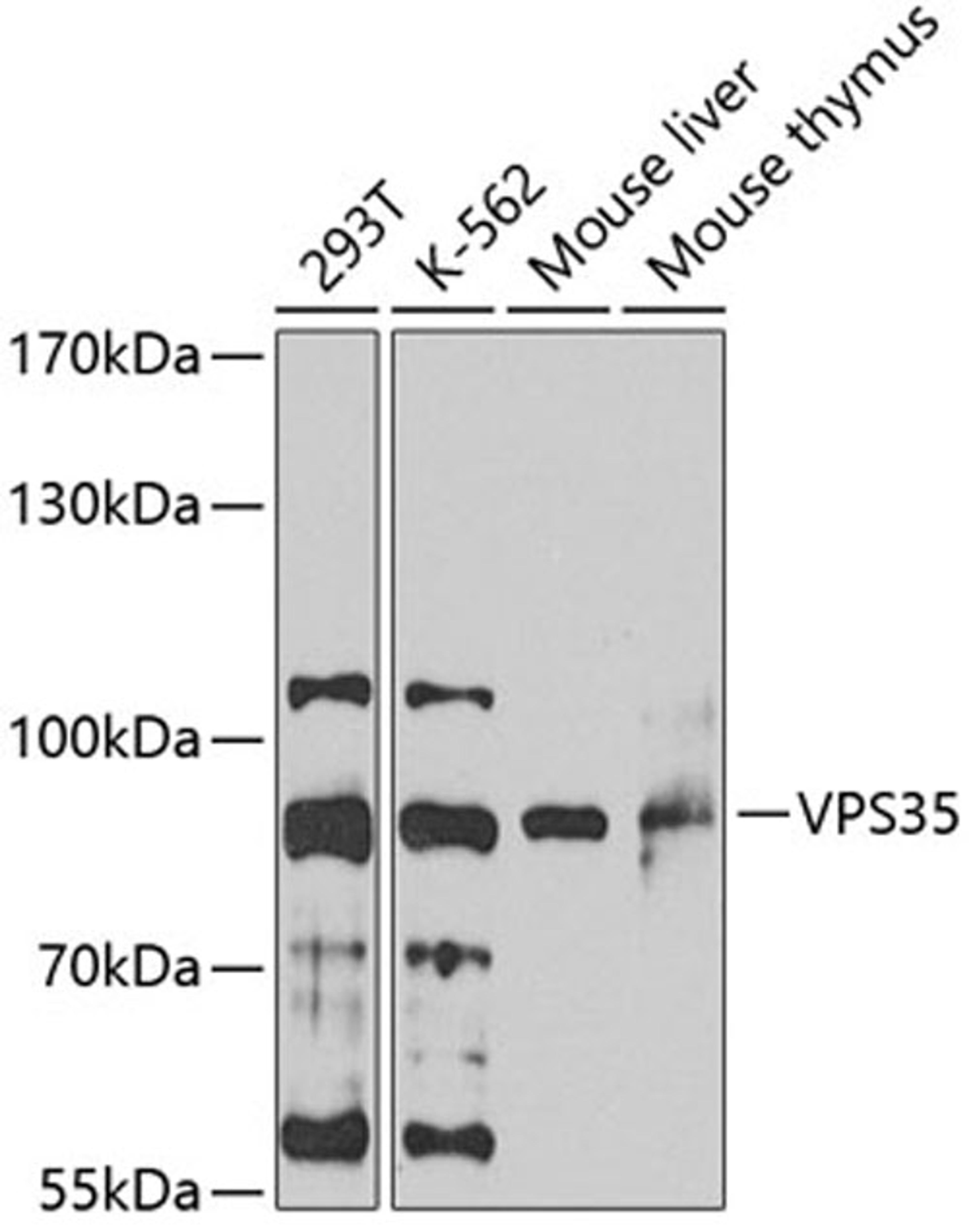 Western blot - VPS35 antibody (A7117)