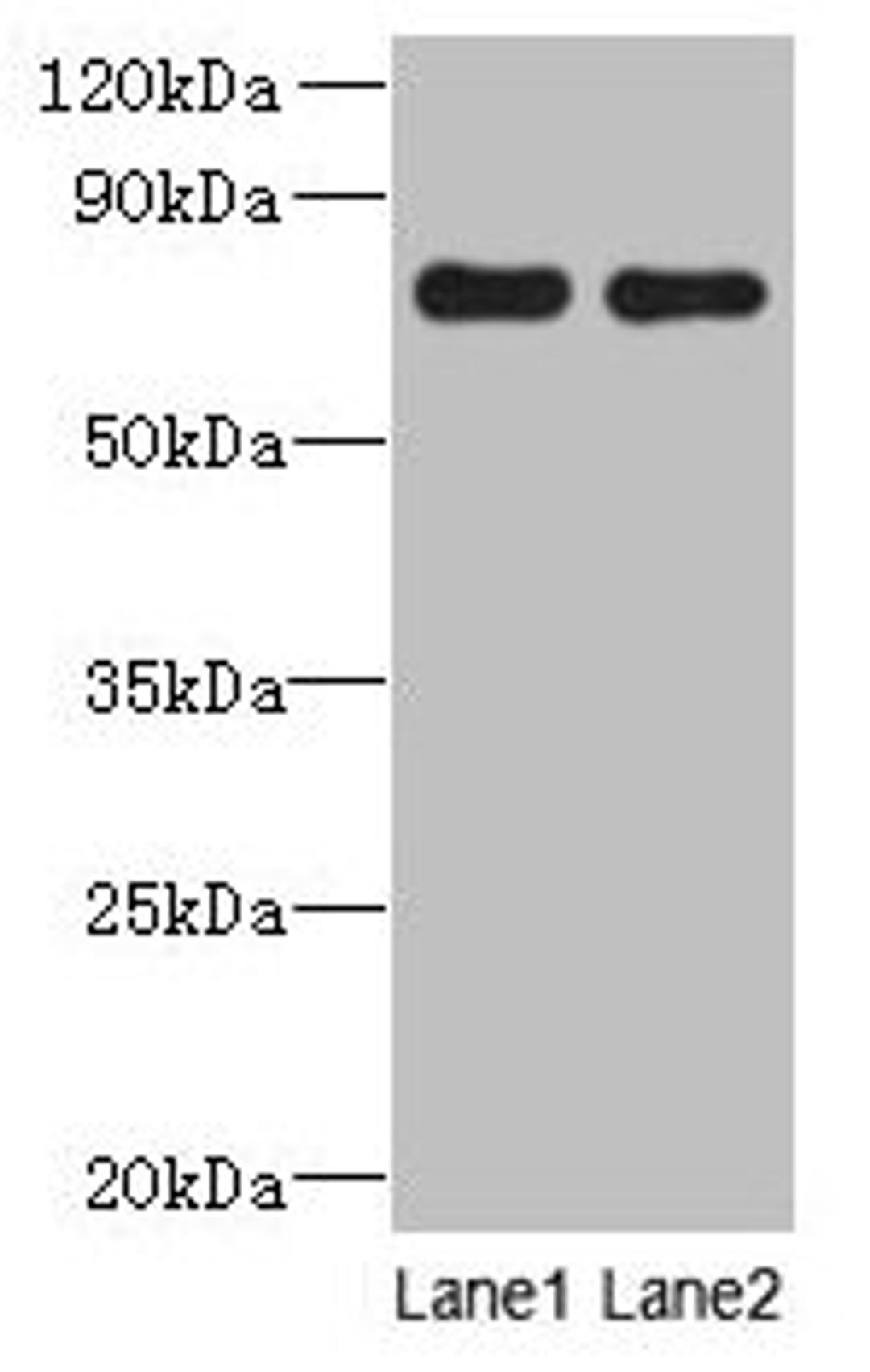 Western blot. All lanes: ACTR8 antibody at 16µg/ml. Lane 1: A549 whole cell lysate. Lane 2: HCT116 whole cell lysate. Secondary. Goat polyclonal to rabbit IgG at 1/10000 dilution. Predicted band size: 71, 59, 37 kDa. Observed band size: 71 kDa