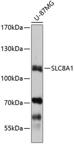 Western blot - SLC8A1 antibody (A7419)