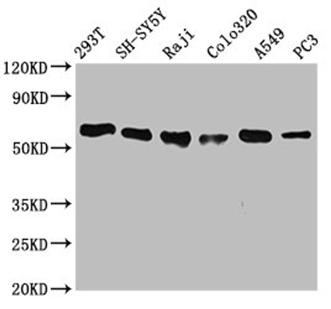 Western Blot. Positive WB detected in: 293T whole cell lysate, SH-SY5Y whole cell lysate, Raji whole cell lysate, Colo320 whole cell lysate, A549 whole cell lysate, PC3 whole cell lysate. All lanes: FTO antibody at 0.7μg/ml. Secondary. Goat polyclonal to rabbit IgG at 1/50000 dilution. Predicted band size: 59, 15, 7, 13 KDa. Observed band size: 59 KDa.