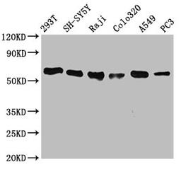Western Blot. Positive WB detected in: 293T whole cell lysate, SH-SY5Y whole cell lysate, Raji whole cell lysate, Colo320 whole cell lysate, A549 whole cell lysate, PC3 whole cell lysate. All lanes: FTO antibody at 0.7μg/ml. Secondary. Goat polyclonal to rabbit IgG at 1/50000 dilution. Predicted band size: 59, 15, 7, 13 KDa. Observed band size: 59 KDa.