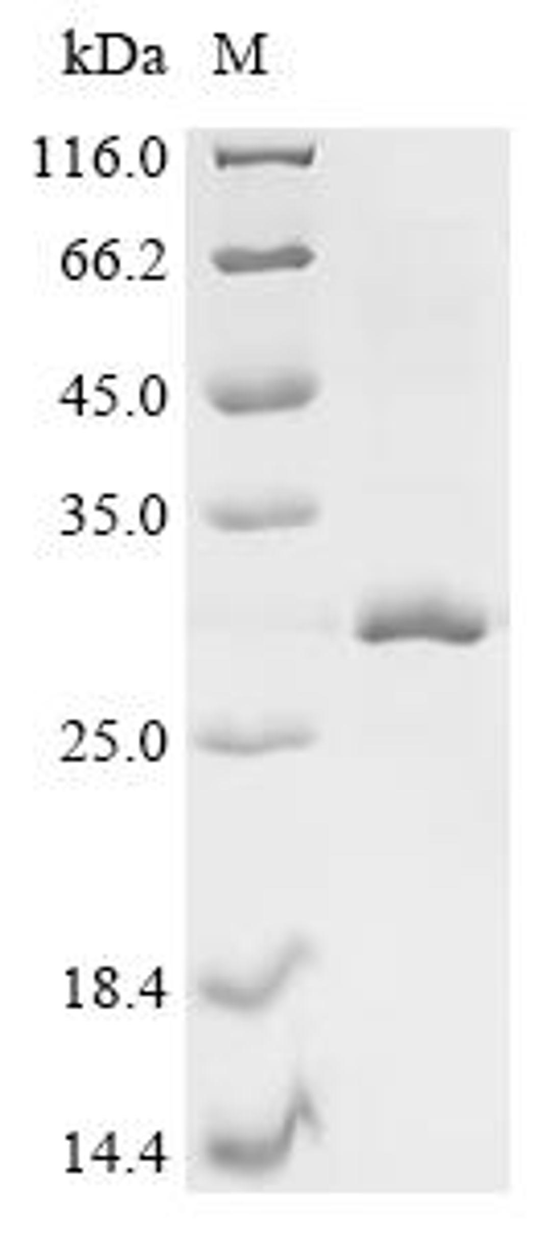 (Tris-Glycine gel) Discontinuous SDS-PAGE (reduced) with 5% enrichment gel and 15% separation gel.