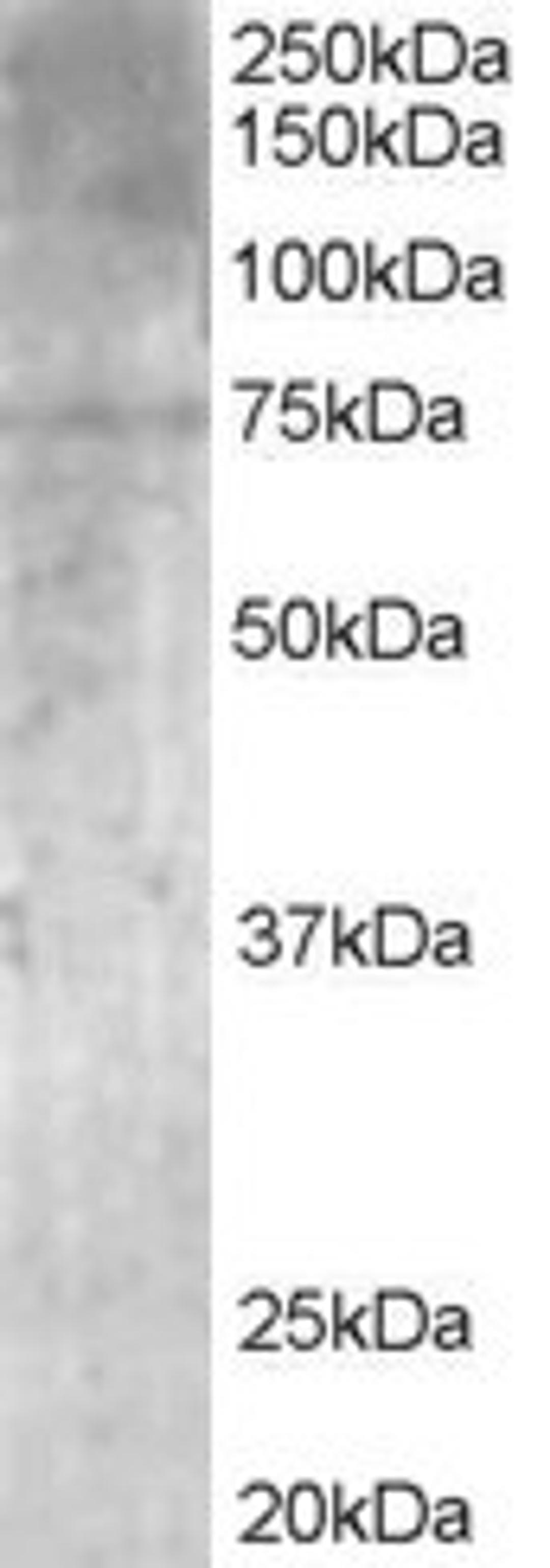 45-898 (1ug/ml) staining of Human Brain lysate (35ug protein in RIPA buffer). Primary incubation was 1 hour. Detected by chemiluminescence.