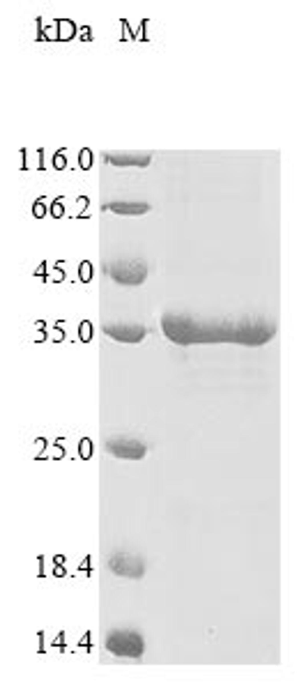 (Tris-Glycine gel) Discontinuous SDS-PAGE (reduced) with 5% enrichment gel and 15% separation gel.