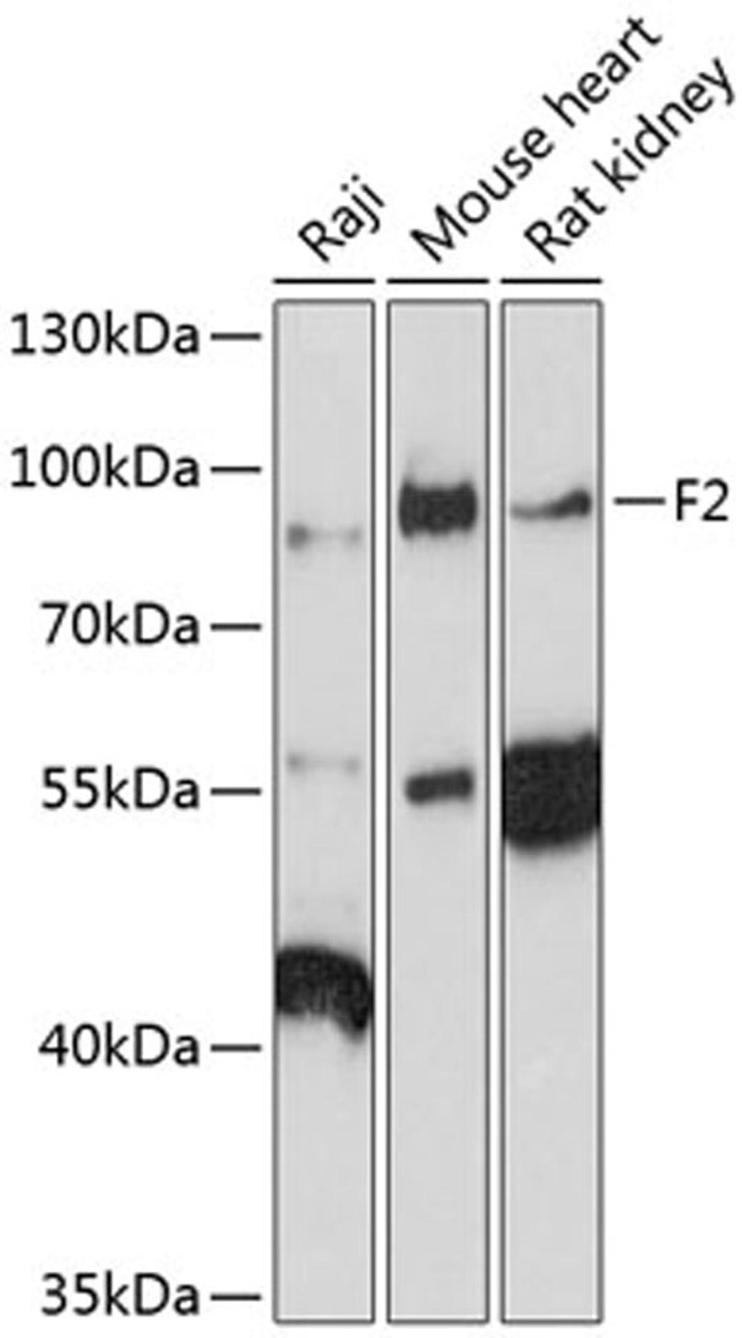 Western blot - F2 antibody (A12382)