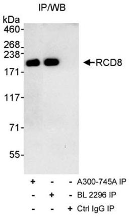 Detection of human RCD8 by western blot of immunoprecipitates.