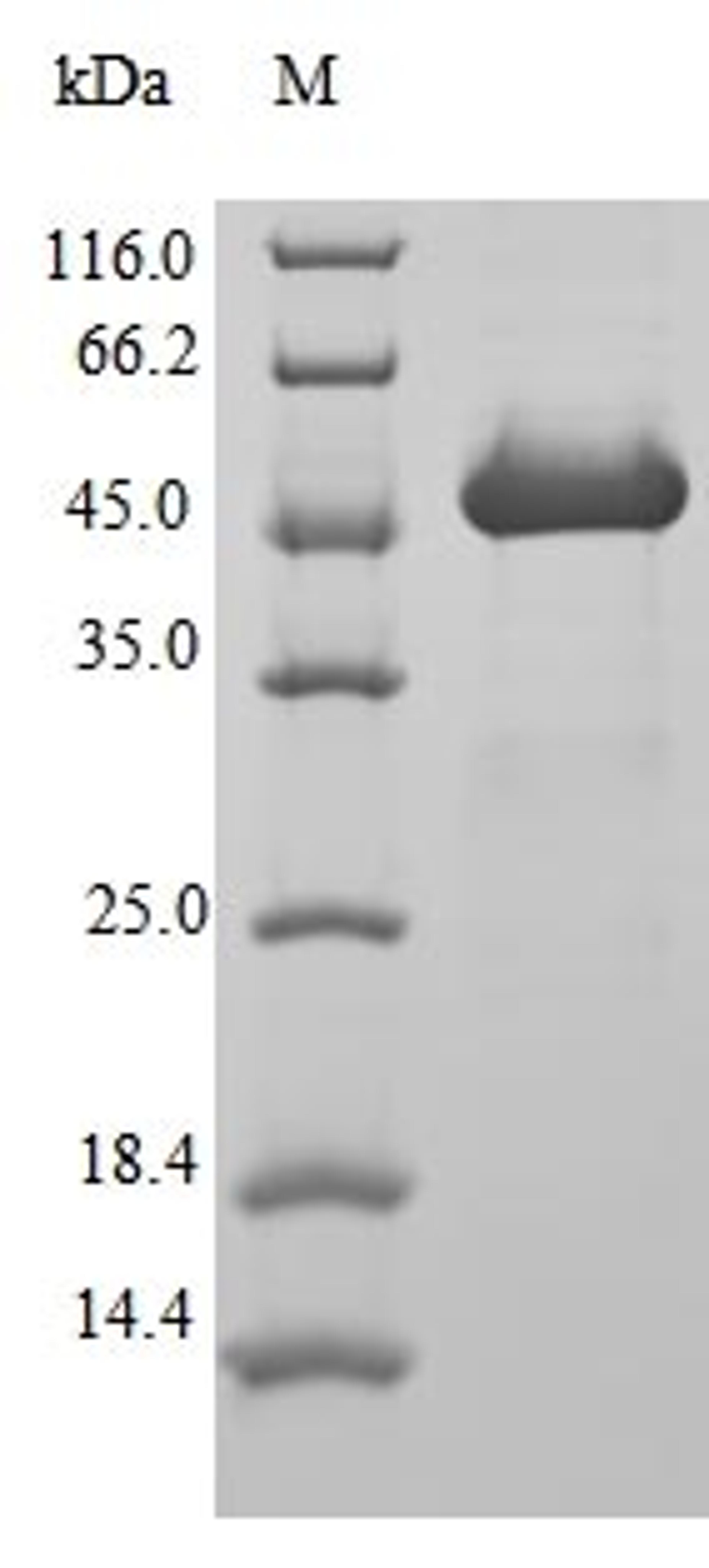 (Tris-Glycine gel) Discontinuous SDS-PAGE (reduced) with 5% enrichment gel and 15% separation gel.