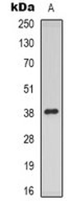 Western blot analysis of HuvEc (Lane 1) whole cell lysates using mPR gamma antibody