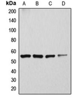 Western blot analysis of Caki1 (Lane 1), SKNSH (Lane 2), rat kidney (Lane 3), mouse brain (Lane 4) whole cell lysates using ATP6V1H antibody