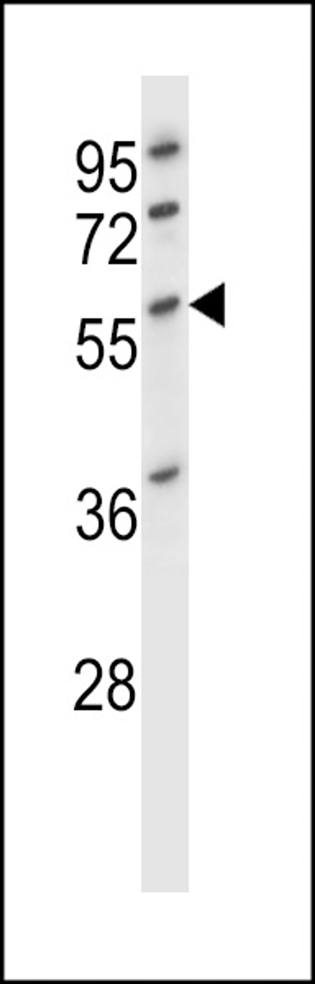 Western blot analysis in HL-60 cell line lysates (35ug/lane).This demonstrates the DES antibody detected the DES protein (arrow).