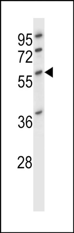 Western blot analysis in HL-60 cell line lysates (35ug/lane).This demonstrates the DES antibody detected the DES protein (arrow).