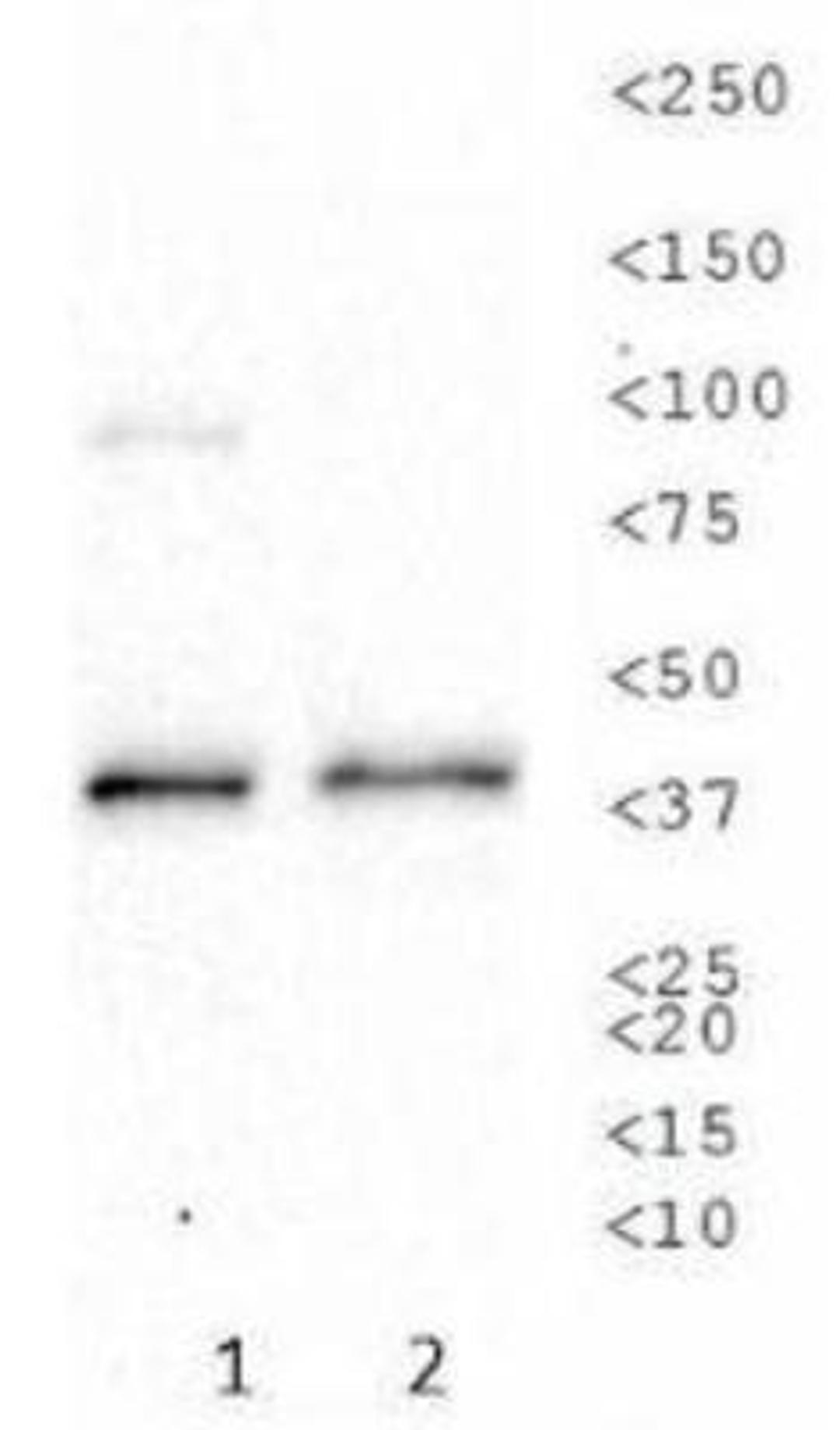 Western Blot: Sodium Potassium ATPase Beta 1 Antibody (464.8 (also known as 8A)) [NB300-147] - Western blot analysis of Sodium Potassium ATPase Beta 1 expression in 1) SK-BR-3 and 2) A-431 whole cell lysates using NB300-147.