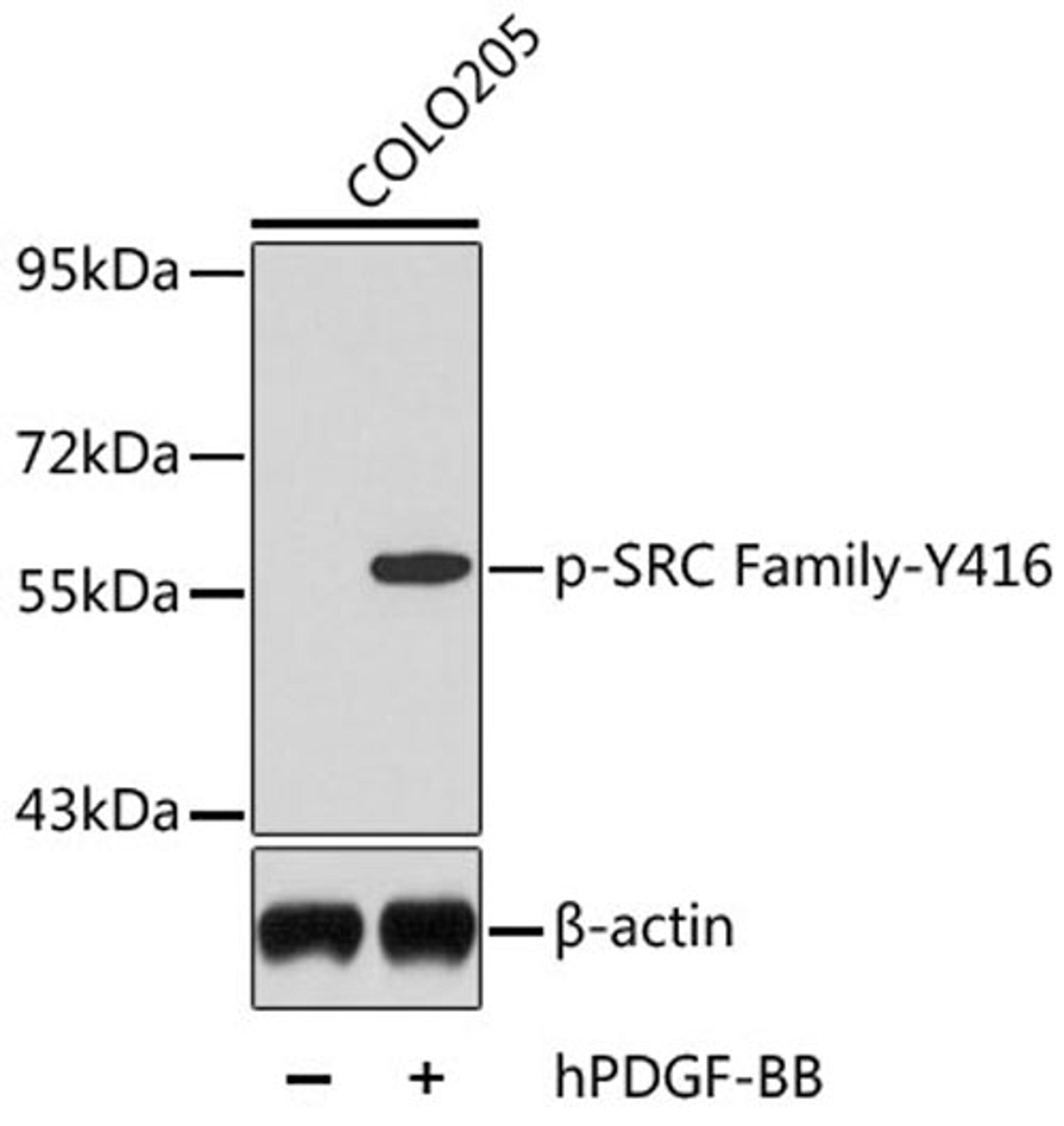 Western blot - Phospho-SRC Family-Y416 antibody (AP0452)