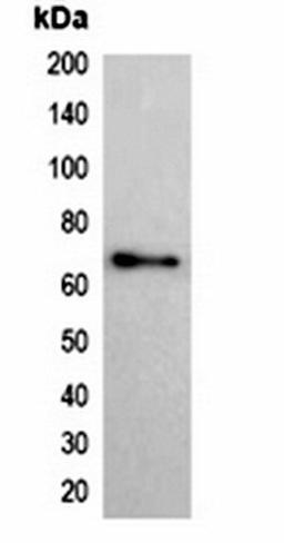 Western blot analysis of 293T cell lysate using His-tag antibody