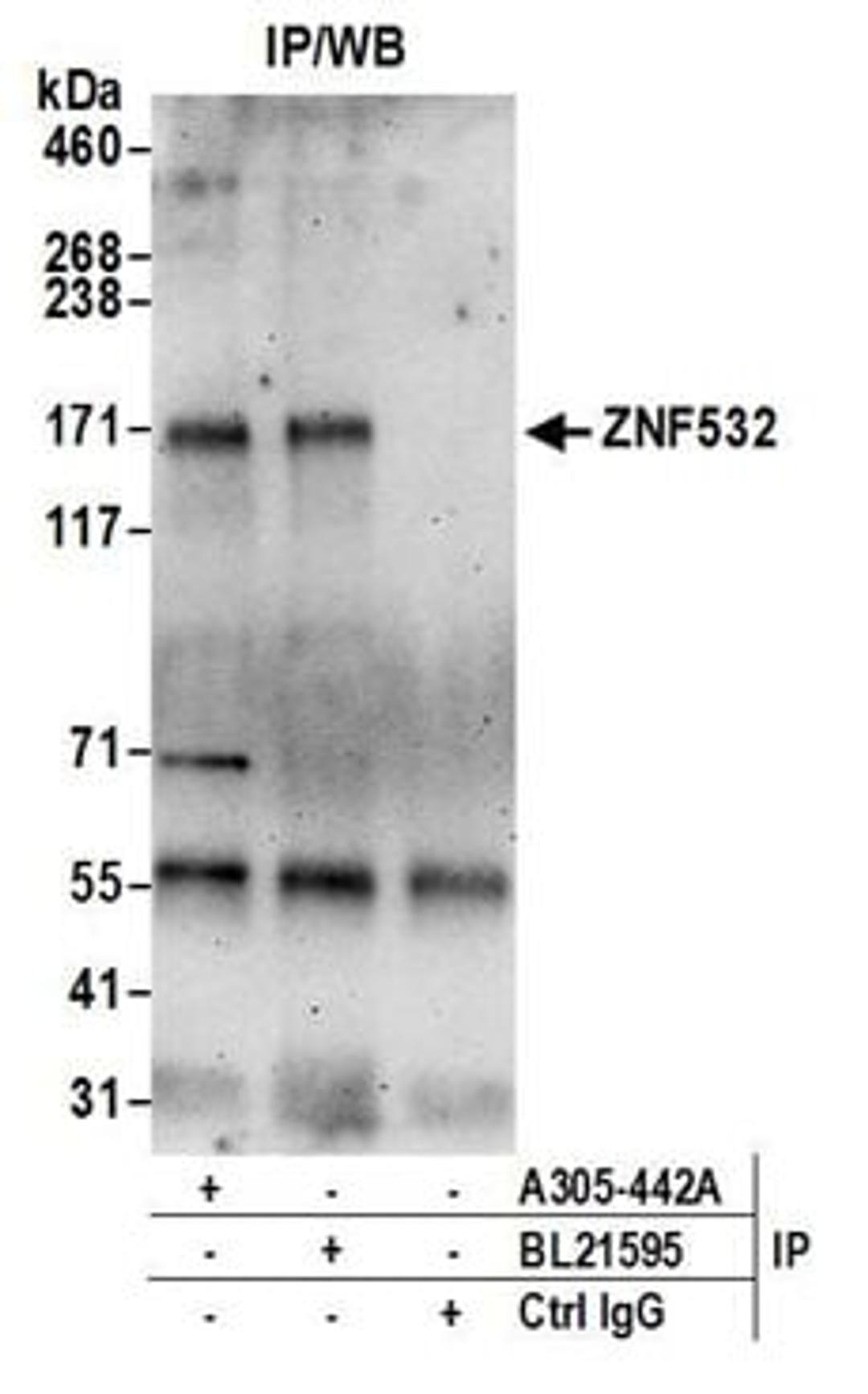 Detection of human ZNF532 by western blot of immunoprecipitates.