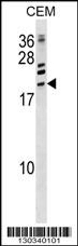 Western blot analysis in CEM cell line lysates (35ug/lane).