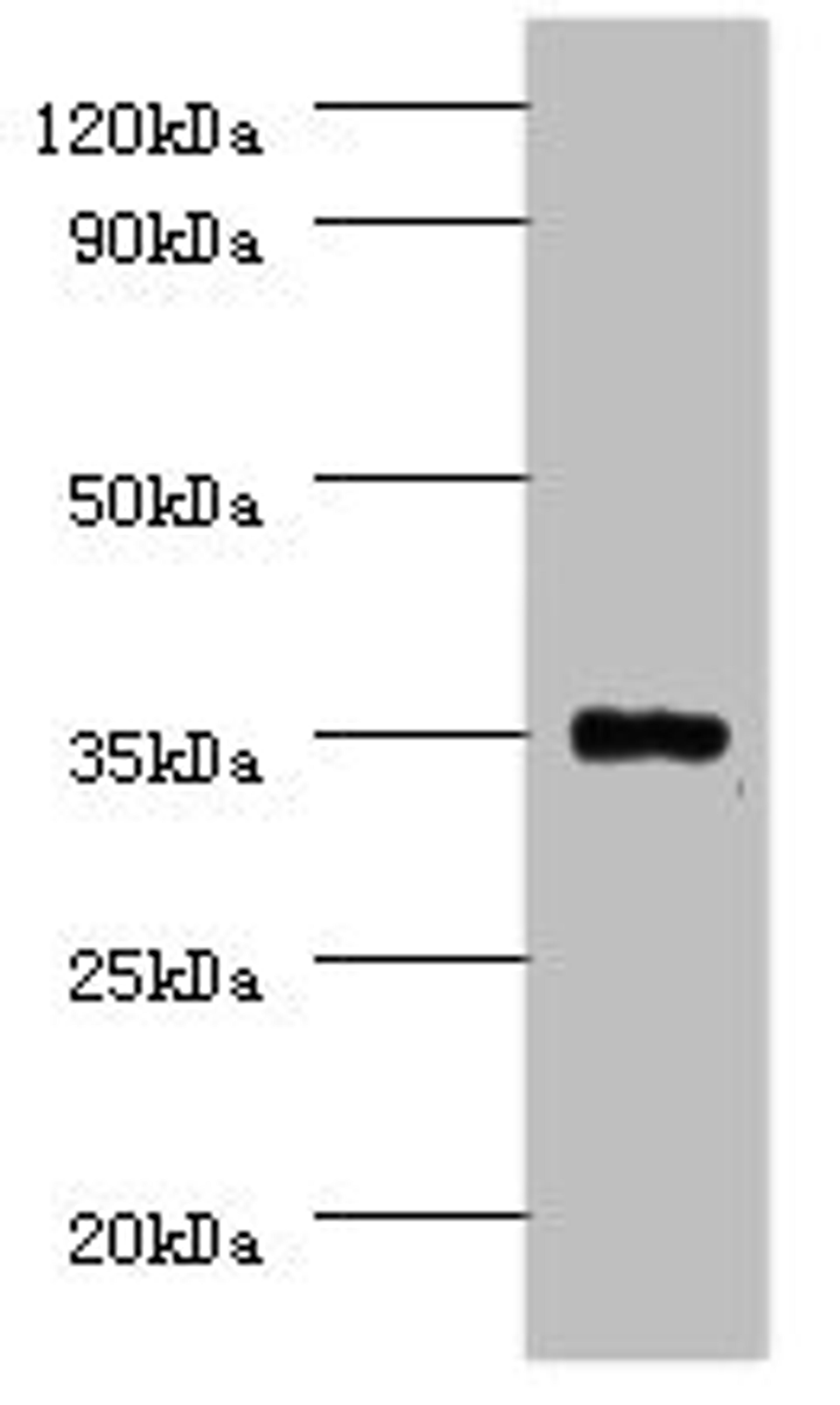 Western blot. All lanes: Serine/threonine-protein phosphatase 2A catalytic subunit beta isoform Antibody at 2µg/ml + EC109 whole cell lysate. Secondary. Goat polyclonal to rabbit IgG at 1/15000 dilution. Predicted band size: 34 kDa. Observed band size: 34 kDa
