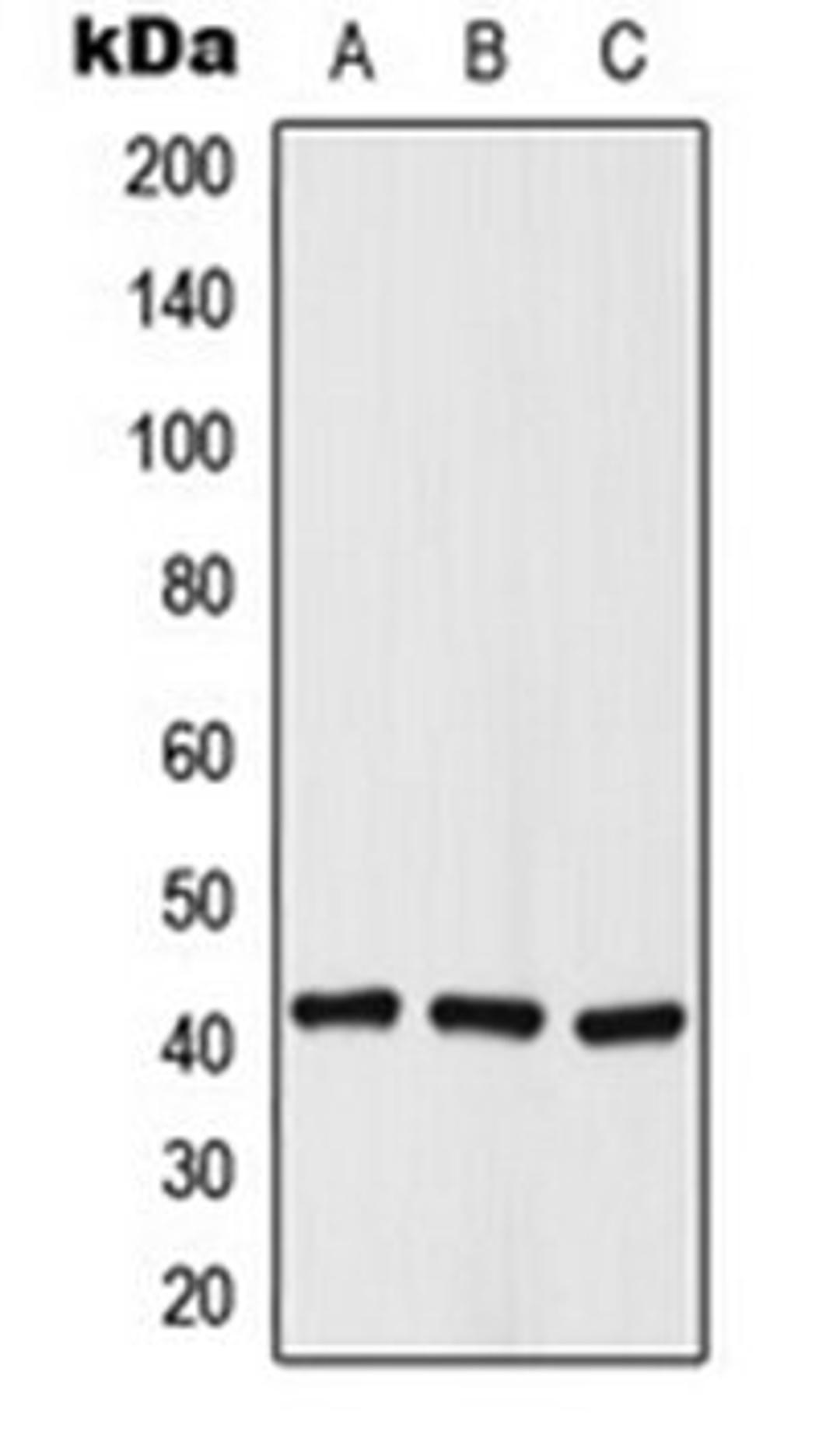 Western blot analysis of A549 (Lane 1), NIH3T3 (Lane 2), rat kidney (Lane 3) whole cell lysates using Histone Deacetylase 8 (phospho-S39) antibody