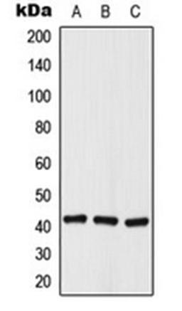 Western blot analysis of A549 (Lane 1), NIH3T3 (Lane 2), rat kidney (Lane 3) whole cell lysates using Histone Deacetylase 8 (phospho-S39) antibody