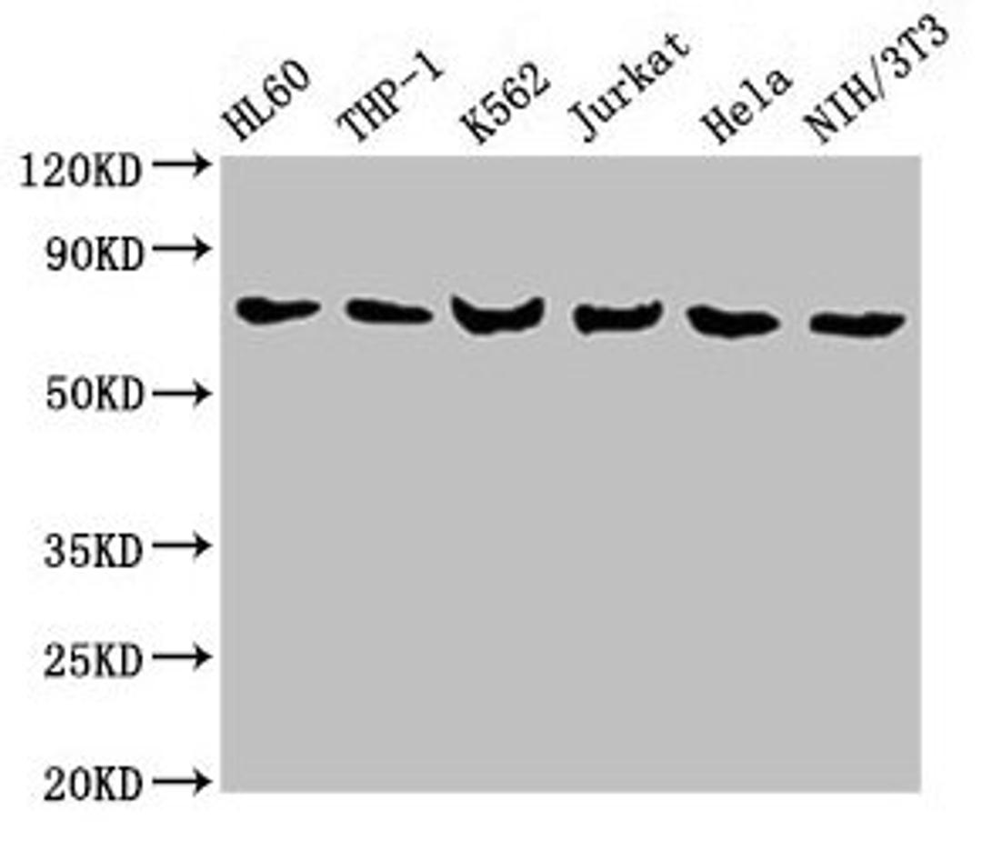 Western Blot. Positive WB detected in: HL60 whole cell lysate, THP-1 whole cell lysate, K562 whole cell lysate, Jurkat whole cell lysate, Hela whole cell lysate, NIH/3T3 whole cell lysate. All lanes: LCP1 antibody at 8µg/ml. Secondary. Goat polyclonal to rabbit IgG at 1/10000 dilution. Predicted band size: 71, 22 kDa. Observed band size: 71 kDa
