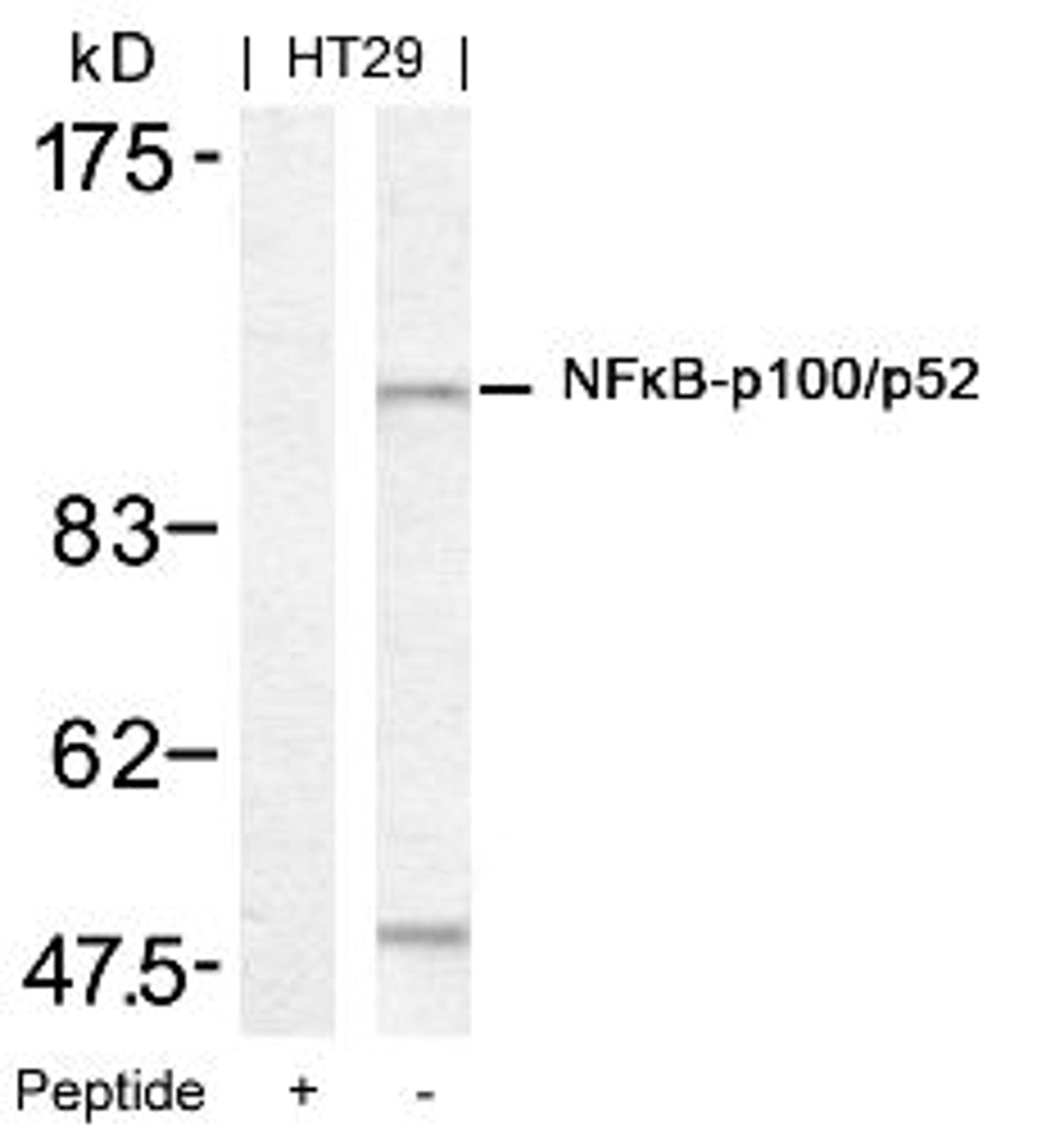 Western blot analysis of lysed extracts from HT29 cells using NF&#954;B-p100/p52 (Ab-872).