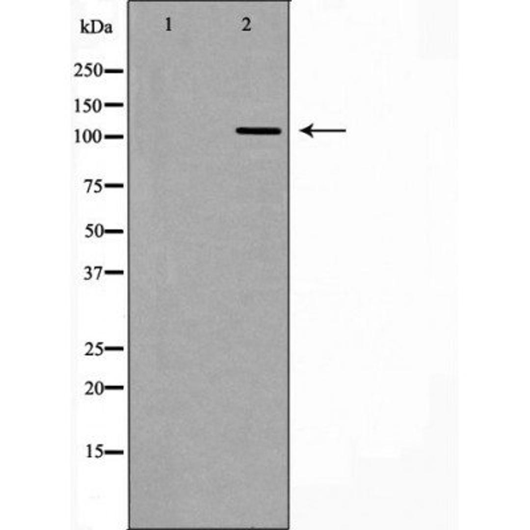 Western blot analysis of mouse testis tissue using RASA1 antibody