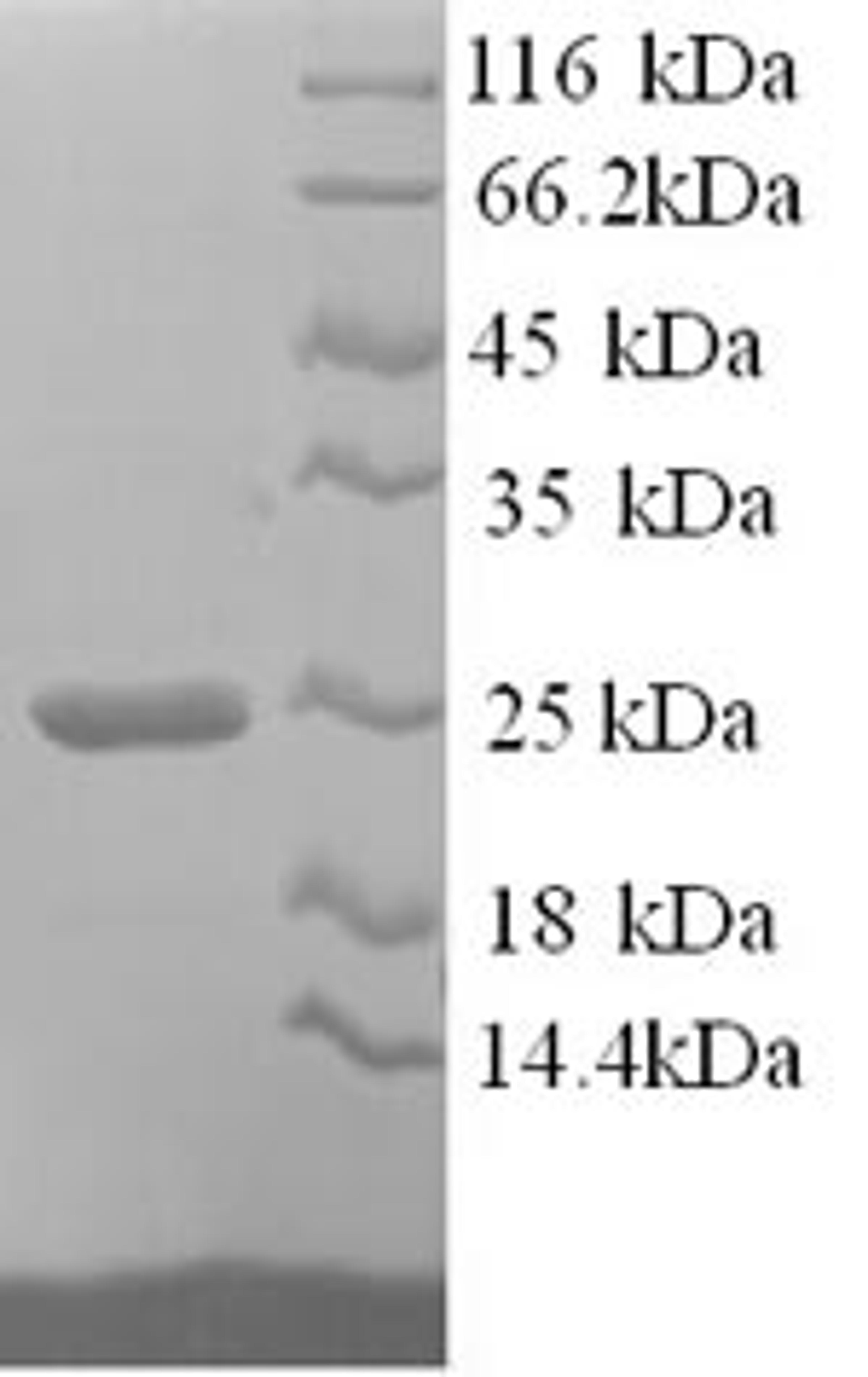 (Tris-Glycine gel) Discontinuous SDS-PAGE (reduced) with 5% enrichment gel and 15% separation gel.